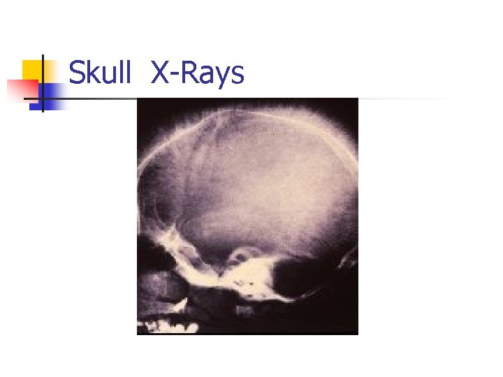 Skull X-Rays 