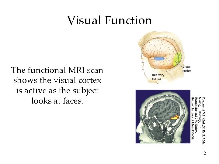 Visual Function Courtesy of V. P. Clark, K. Keill, J. Maisog, S. Courtney, L.