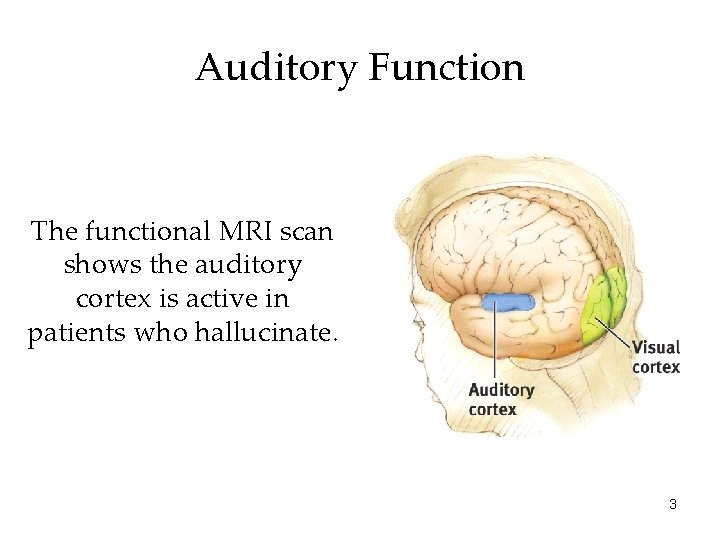 Auditory Function The functional MRI scan shows the auditory cortex is active in patients