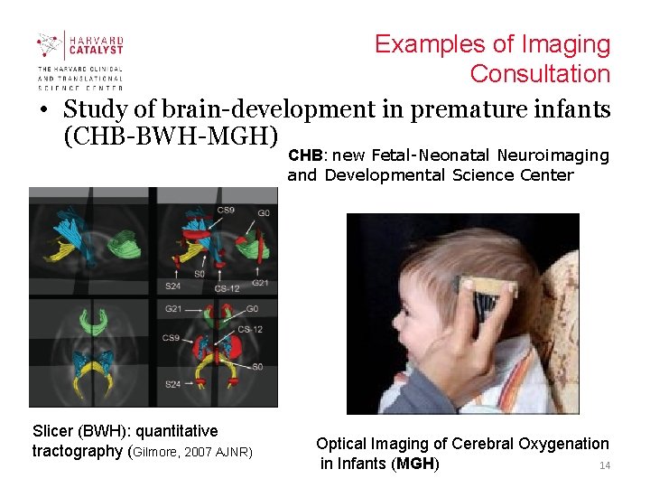 Examples of Imaging Consultation • Study of brain-development in premature infants (CHB-BWH-MGH) CHB: new