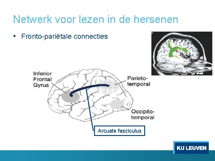 Netwerk voor lezen in de hersenen • Fronto-pariëtale connecties Arcuate fasciculus 