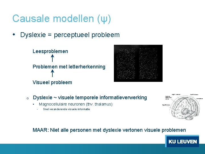 Causale modellen (ψ) • Dyslexie = perceptueel probleem Leesproblemen Problemen met letterherkenning Visueel probleem