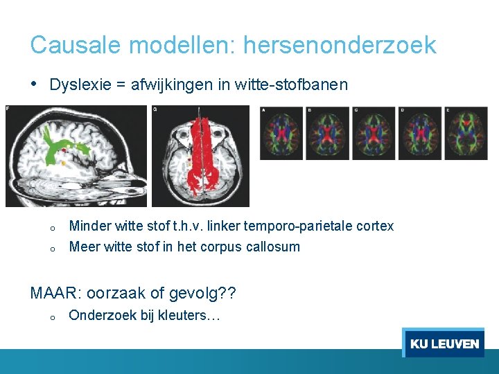 Causale modellen: hersenonderzoek • Dyslexie = afwijkingen in witte-stofbanen o o Minder witte stof