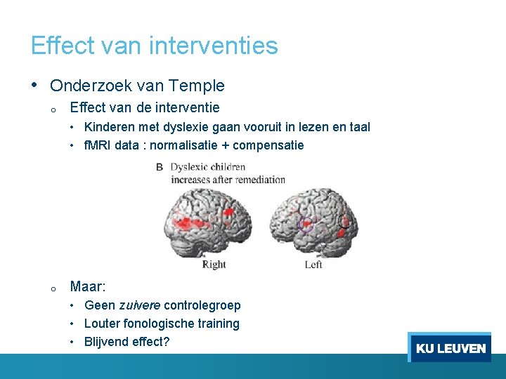 Effect van interventies • Onderzoek van Temple o Effect van de interventie • Kinderen