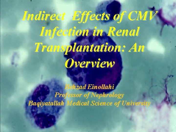 Indirect Effects of CMV Infection in Renal Transplantation: An Overview Behzad Einollahi Professor of