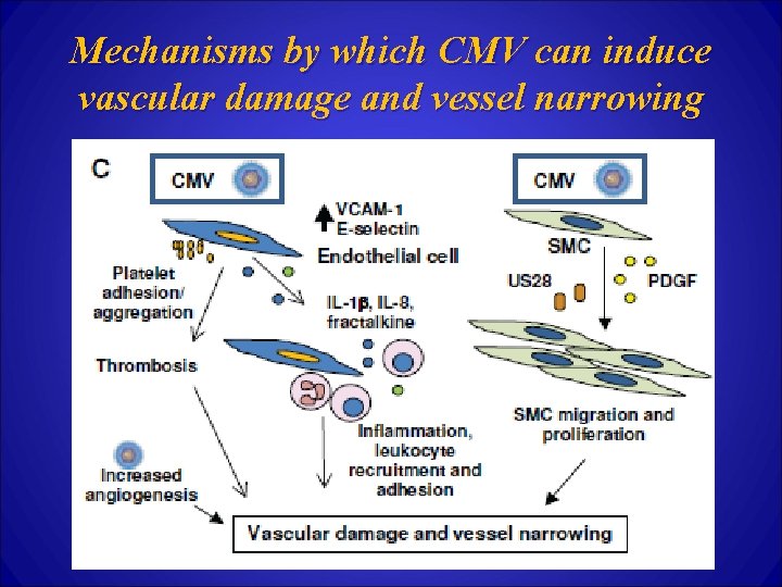 Mechanisms by which CMV can induce vascular damage and vessel narrowing 