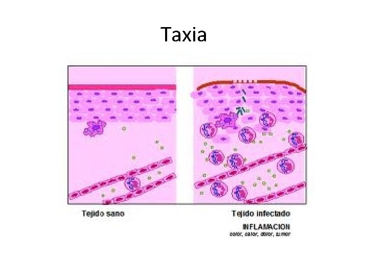 Taxia 