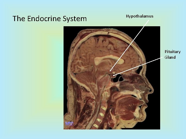 The Endocrine System Hypothalamus Pituitary Gland 