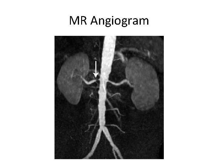 MR Angiogram 