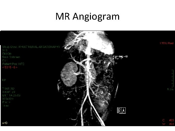 MR Angiogram 