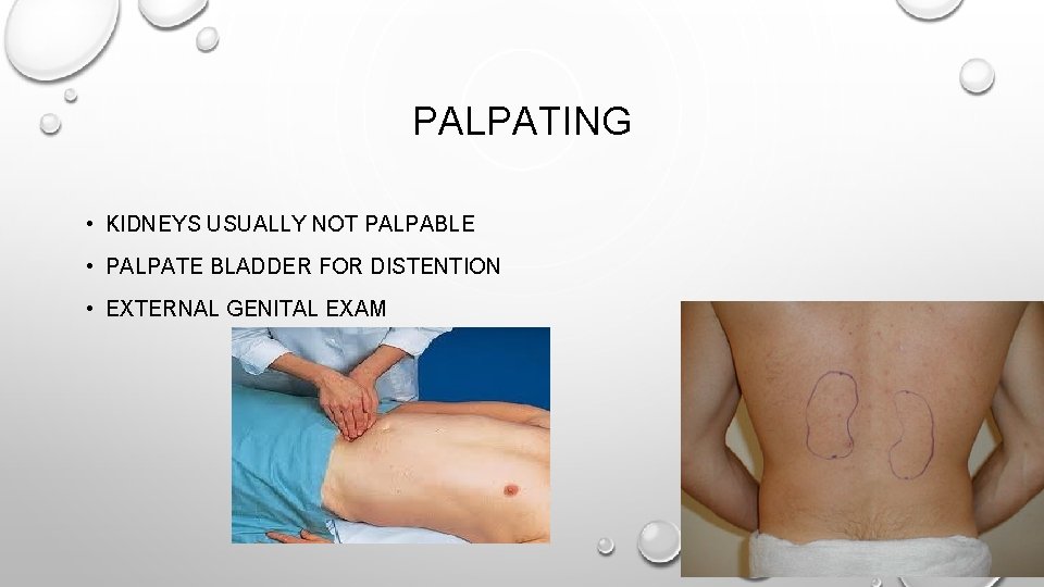 PALPATING • KIDNEYS USUALLY NOT PALPABLE • PALPATE BLADDER FOR DISTENTION • EXTERNAL GENITAL