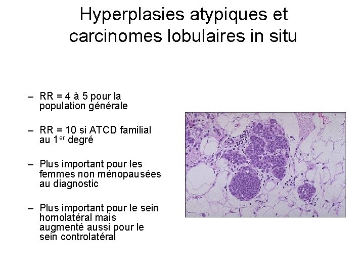 Hyperplasies atypiques et carcinomes lobulaires in situ – RR = 4 à 5 pour