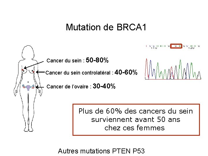 Mutation de BRCA 1 Cancer du sein : 50 -80% Cancer du sein controlatéral