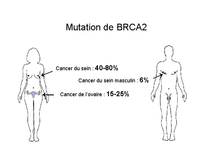 Mutation de BRCA 2 Cancer du sein : 40 -80% Cancer du sein masculin
