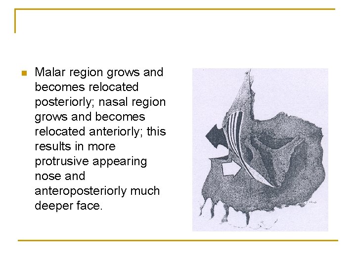 n Malar region grows and becomes relocated posteriorly; nasal region grows and becomes relocated