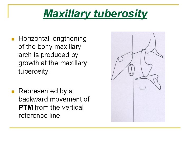 Maxillary tuberosity n Horizontal lengthening of the bony maxillary arch is produced by growth