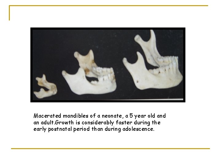 Macerated mandibles of a neonate, a 5 year old an adult. Growth is considerably