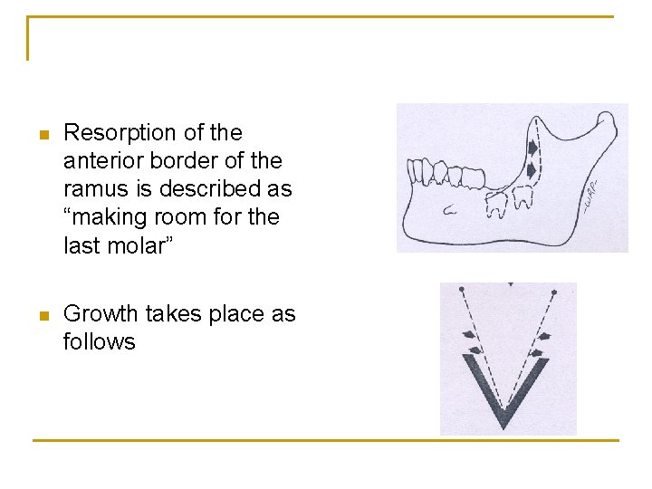 n Resorption of the anterior border of the ramus is described as “making room