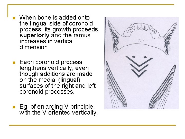 n When bone is added onto the lingual side of coronoid process, its growth