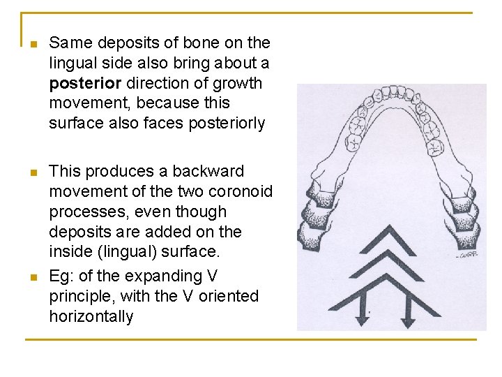n Same deposits of bone on the lingual side also bring about a posterior