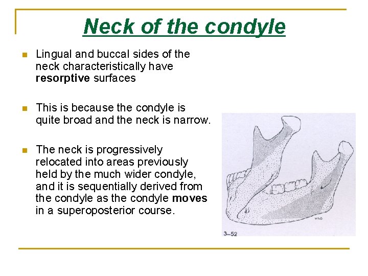 Neck of the condyle n Lingual and buccal sides of the neck characteristically have