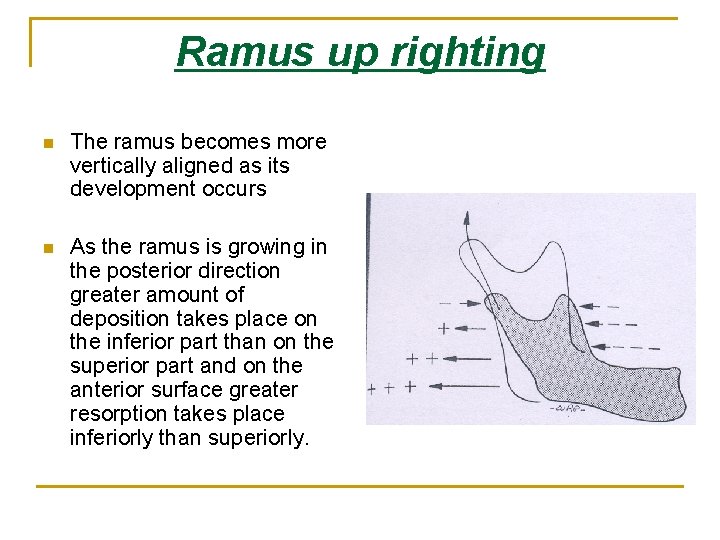 Ramus up righting n The ramus becomes more vertically aligned as its development occurs