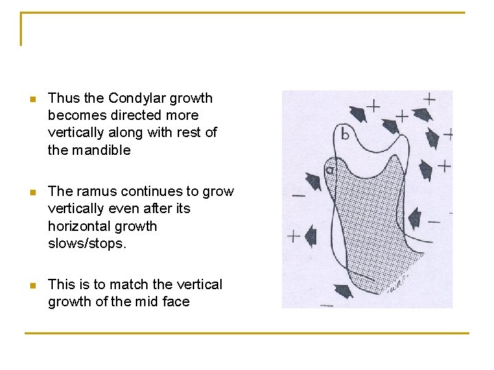 n Thus the Condylar growth becomes directed more vertically along with rest of the