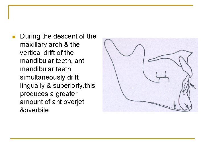 n During the descent of the maxillary arch & the vertical drift of the