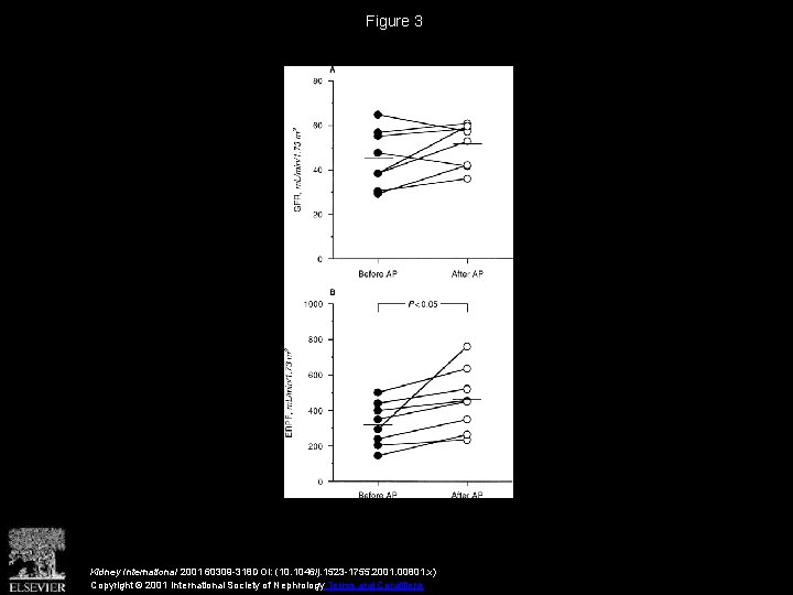 Figure 3 Kidney International 2001 60309 -318 DOI: (10. 1046/j. 1523 -1755. 2001. 00801.