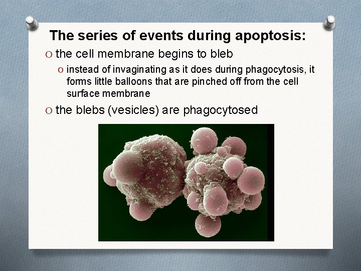 The series of events during apoptosis: O the cell membrane begins to bleb O