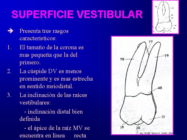 SUPERFICIE VESTIBULAR è Presenta tres rasgos característicos: 1. El tamaño de la corona es