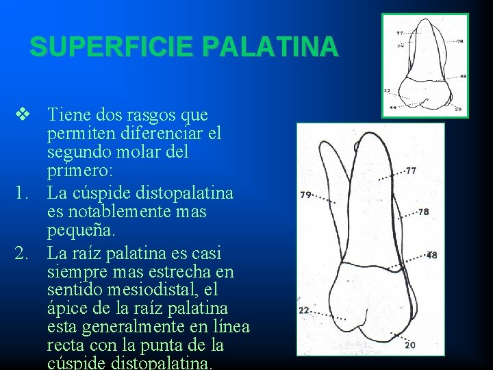 SUPERFICIE PALATINA v Tiene dos rasgos que permiten diferenciar el segundo molar del primero: