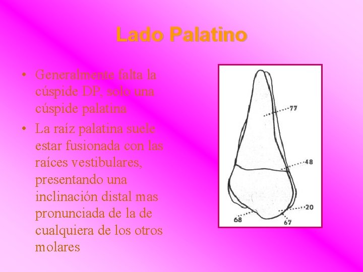 Lado Palatino • Generalmente falta la cúspide DP, solo una cúspide palatina • La