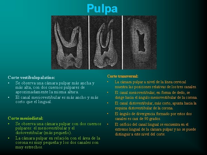 Pulpa Corte vestibulopalatino: • Se observa una cámara pulpar más ancha y más alta,