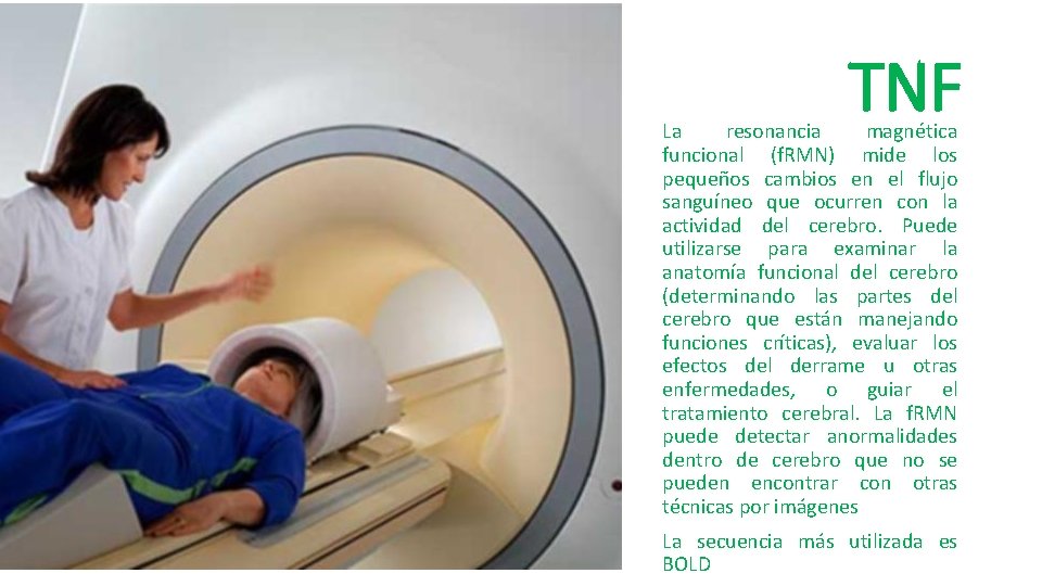 TNF La resonancia magnética funcional (f. RMN) mide los pequeños cambios en el flujo