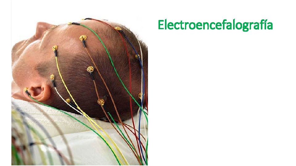 Electroencefalografía 