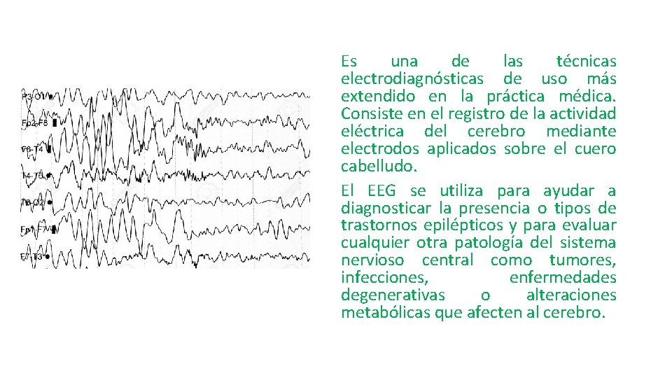 Es una de las técnicas electrodiagnósticas de uso más extendido en la práctica médica.