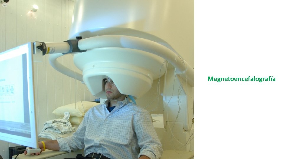 Magnetoencefalografía 