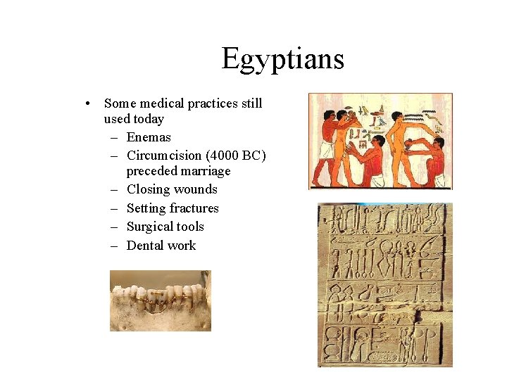 Egyptians • Some medical practices still used today – Enemas – Circumcision (4000 BC)