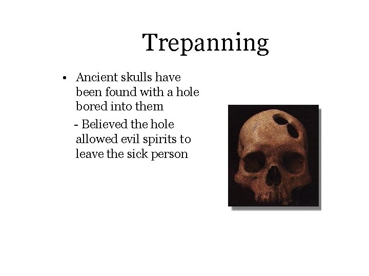 Trepanning • Ancient skulls have been found with a hole bored into them -