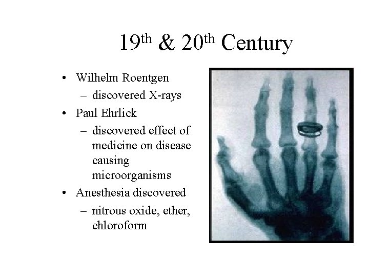 th 19 & th 20 • Wilhelm Roentgen – discovered X-rays • Paul Ehrlick