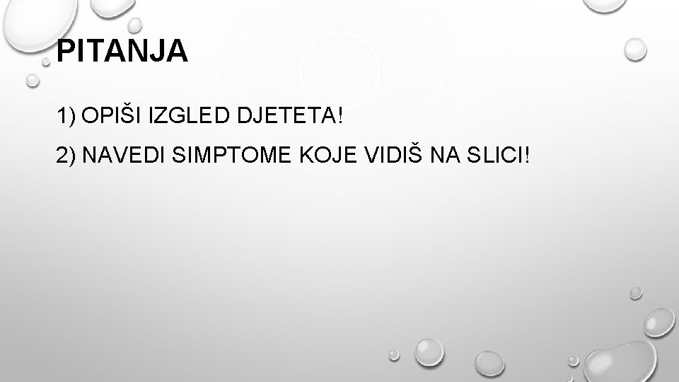 PITANJA 1) OPIŠI IZGLED DJETETA! 2) NAVEDI SIMPTOME KOJE VIDIŠ NA SLICI! 