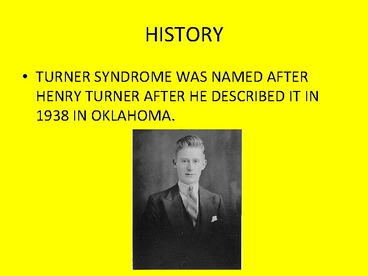 HISTORY • TURNER SYNDROME WAS NAMED AFTER HENRY TURNER AFTER HE DESCRIBED IT IN