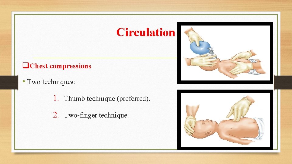 Circulation q. Chest compressions • Two techniques: 1. Thumb technique (preferred). 2. Two-finger technique.