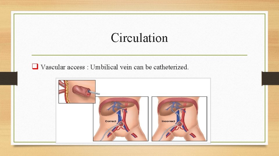 Circulation q Vascular access : Umbilical vein can be catheterized. 