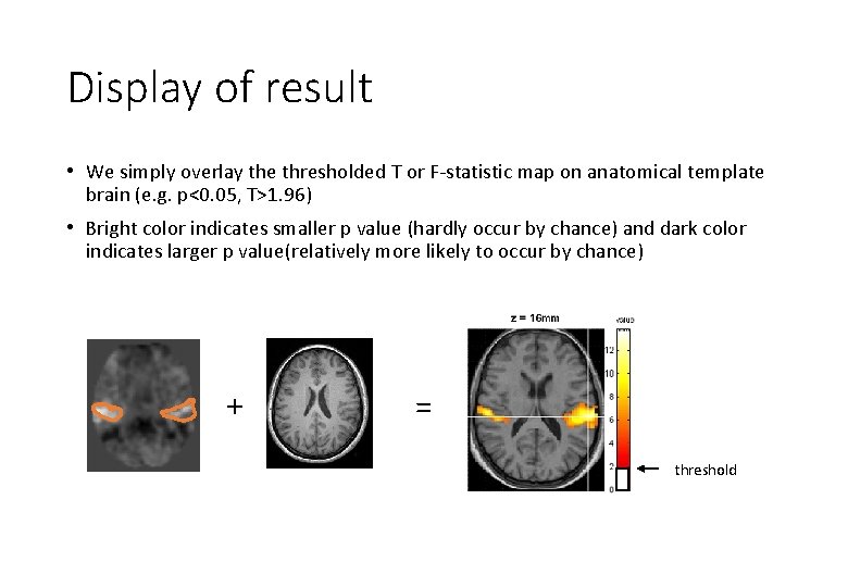 Display of result • We simply overlay the thresholded T or F-statistic map on