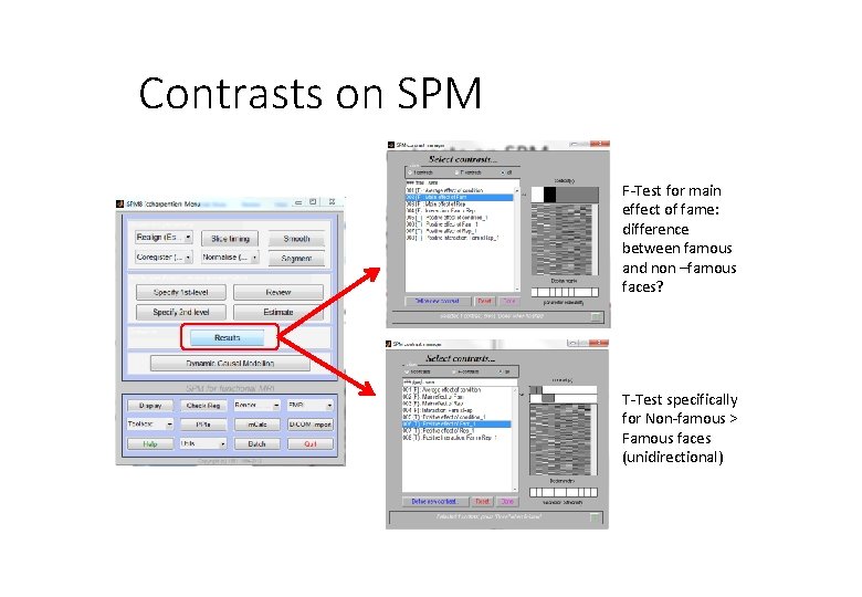 Contrasts on SPM F-Test for main effect of fame: difference between famous and non