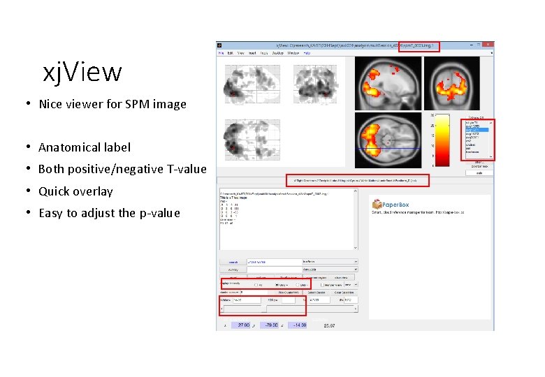 xj. View • Nice viewer for SPM image • Anatomical label • Both positive/negative