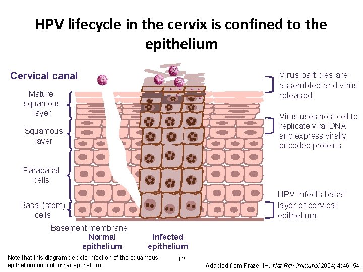 HPV lifecycle in the cervix is confined to the epithelium Cervical canal Virus particles