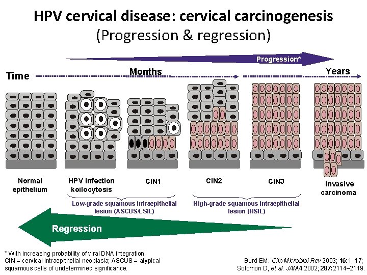 HPV cervical disease: cervical carcinogenesis (Progression & regression) Progression* Normal epithelium Years Months Time